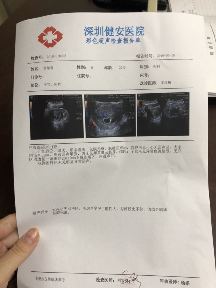 盆腔积液20mm了