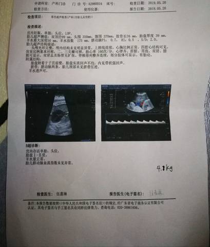 journal_insert_pic_1239355786