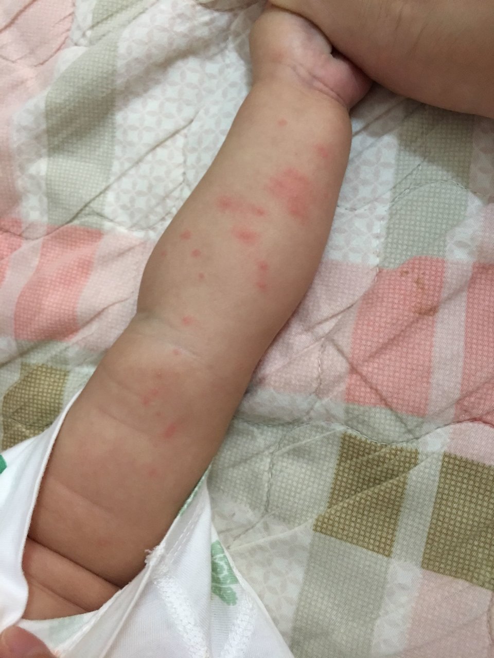 右手上起红点