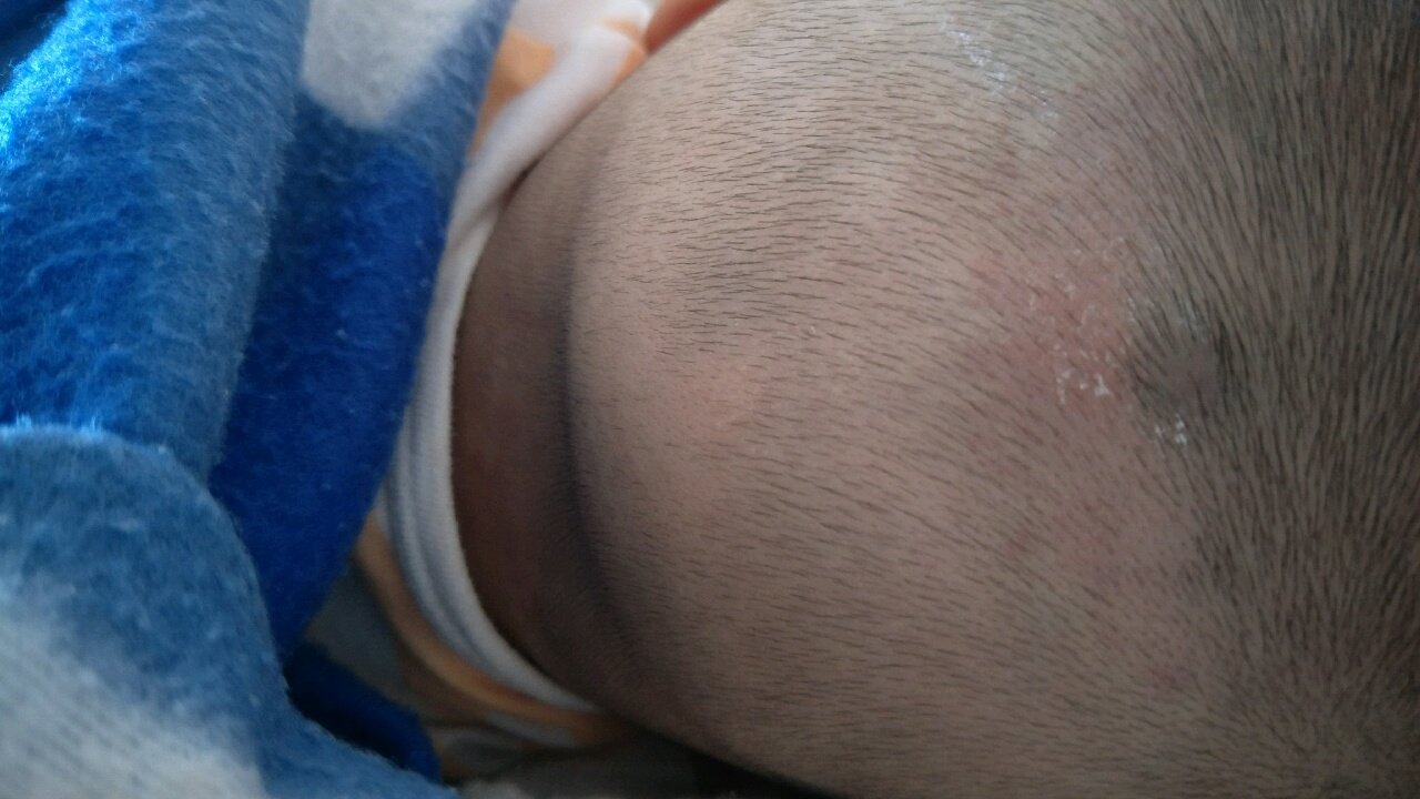 求助贴