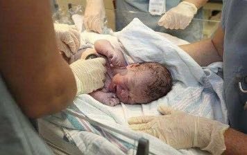 二胎妈妈临产突发脐带脱垂，医生7分钟救回女婴！
