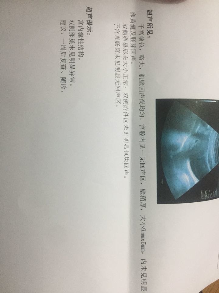 懂的进来说一下