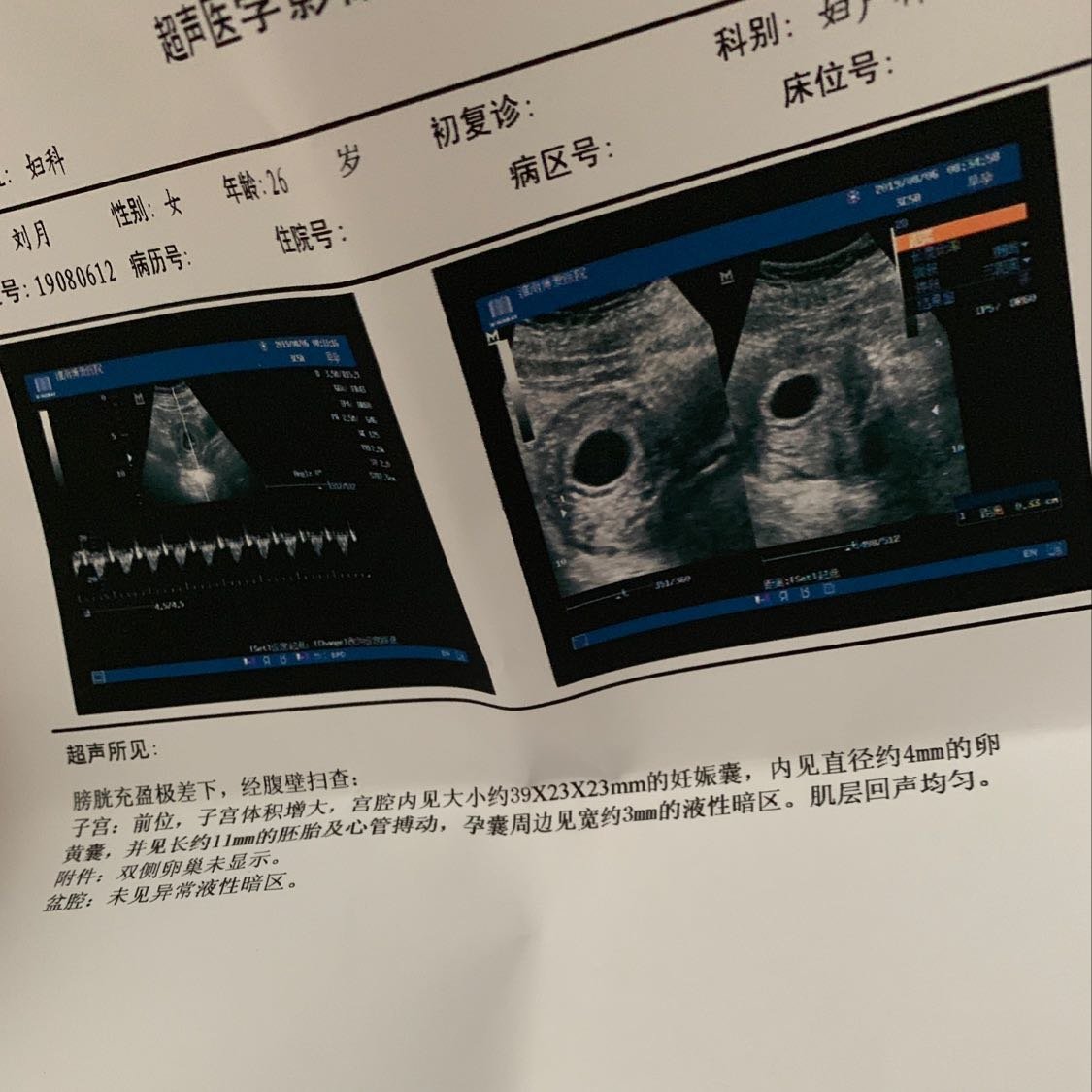 大家好，第一次做妈妈，有点紧张！