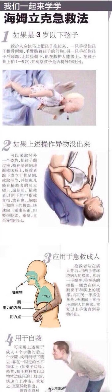 小孩，成人异物卡喉，急救法