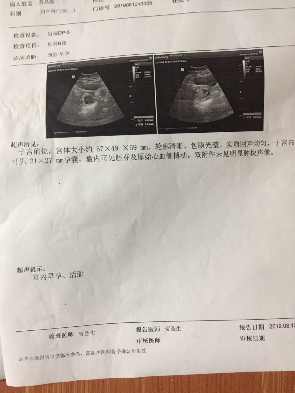 孕7周到8周