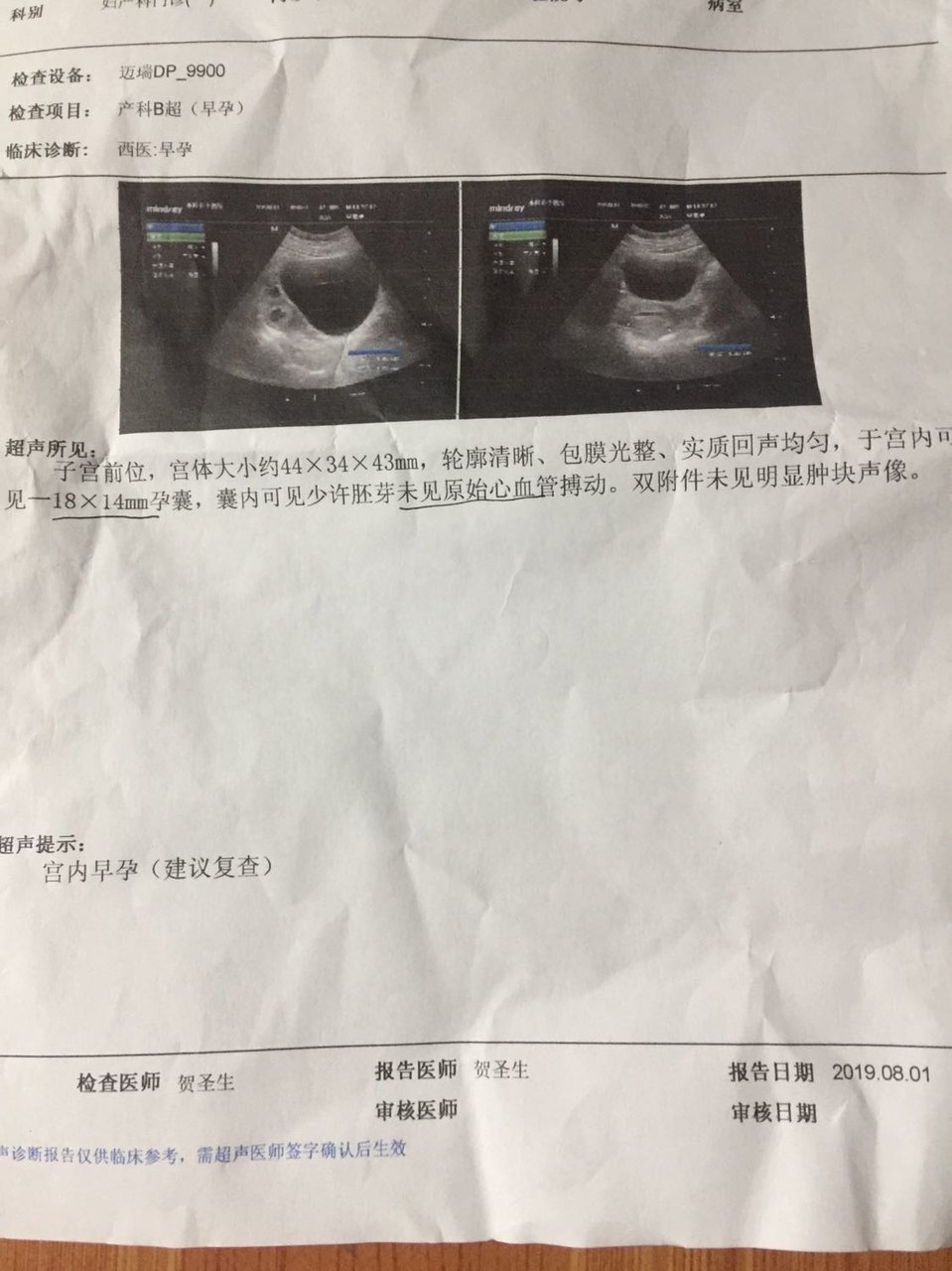 孕7周到8周