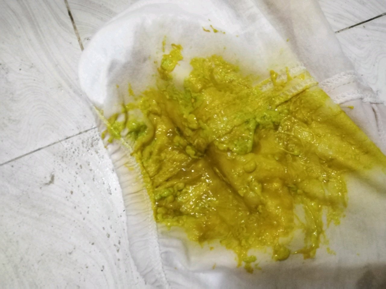 宝妈们，有经验吗？这是是什么情况