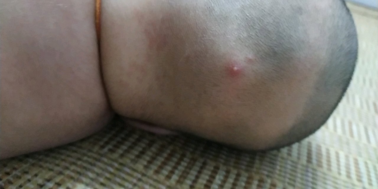 有宝妈遇到宝宝这种情况吗