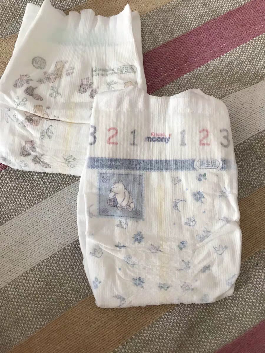 明天去大宝贝体检