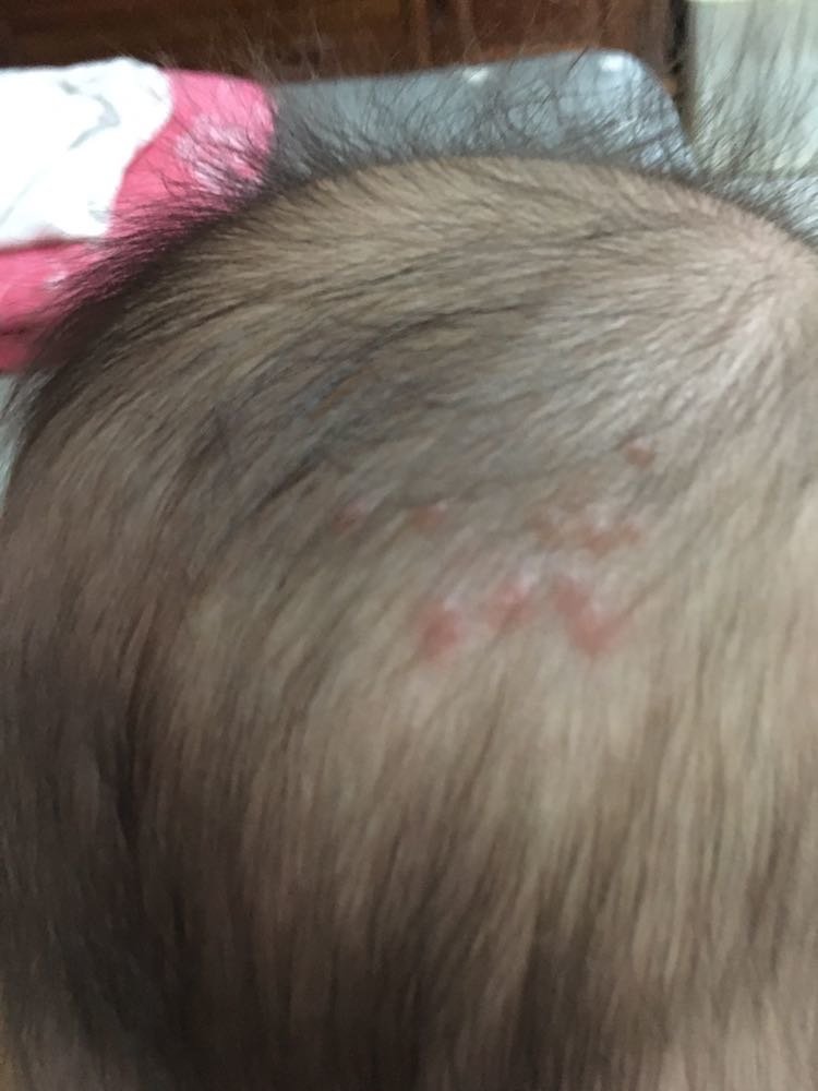 有宝妈知道这长得是什么吗，求知