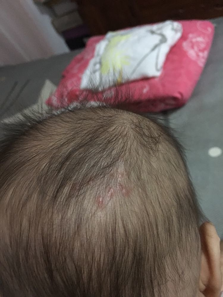 有宝妈知道这长得是什么吗，求知