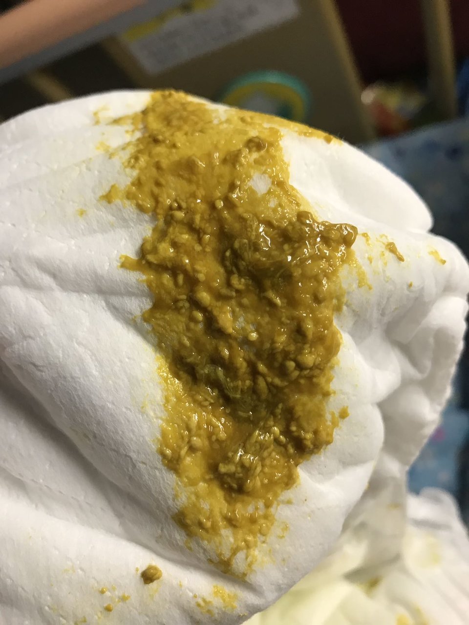 宝宝快七个月，最近总是拉带粘液的大便👀|有图慎入|👀