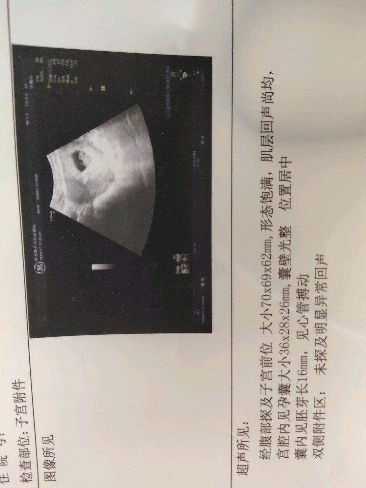 8周1天时候的检查图，帮我看一下男宝女宝吗？