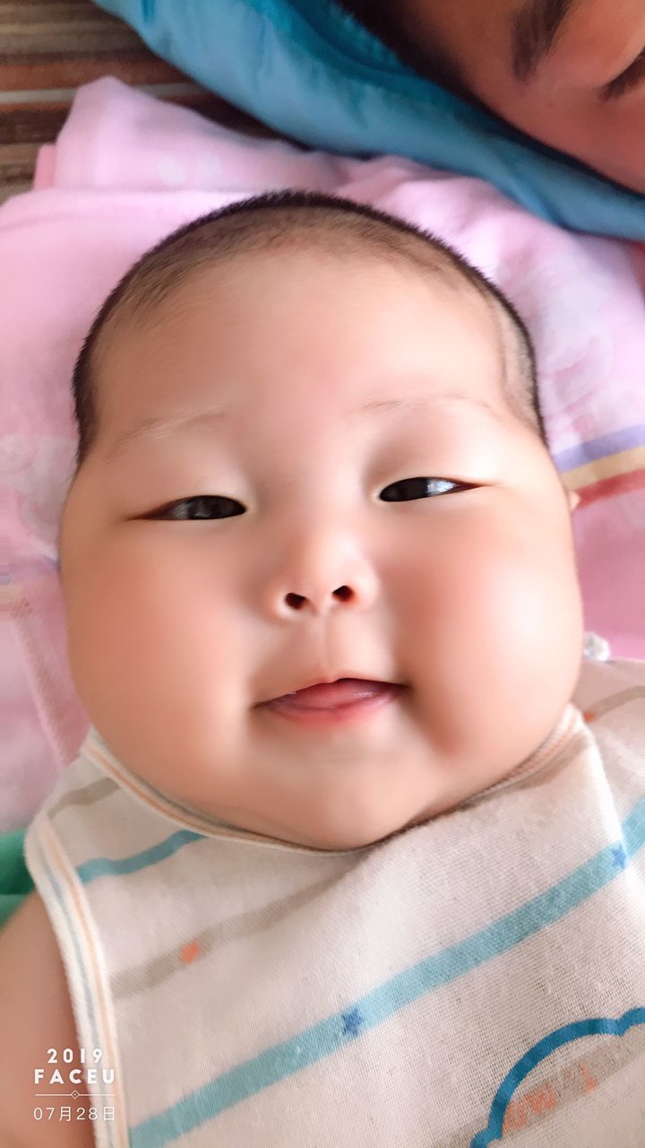 四个半月宝宝  有点对眼  怎么办？？