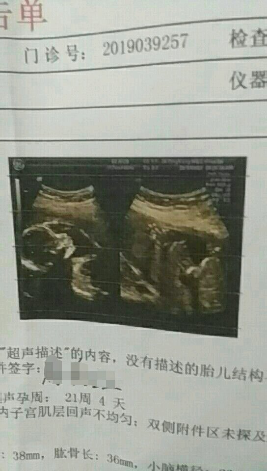 小姑子老大是男孩 这个又是男孩了😳