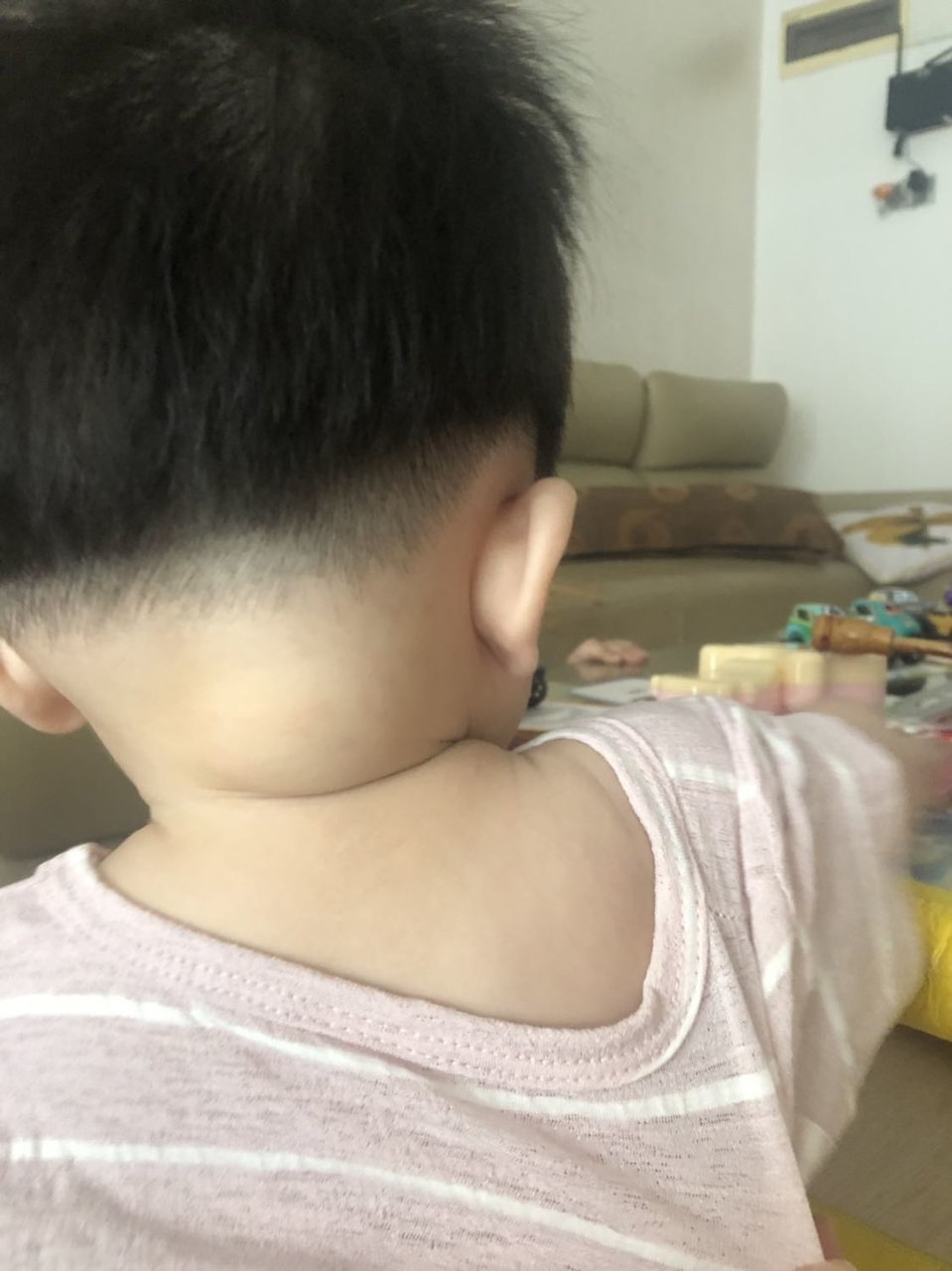 宝宝后面脖子一边肿一边不肿