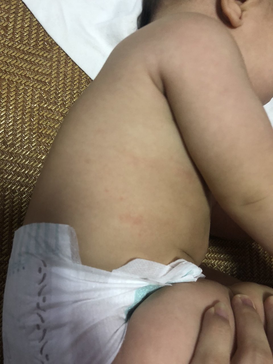 在线等，宝宝身上起一片小红疙瘩