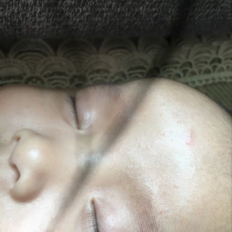 各位宝妈  帮我看下我宝宝这个长的是什么