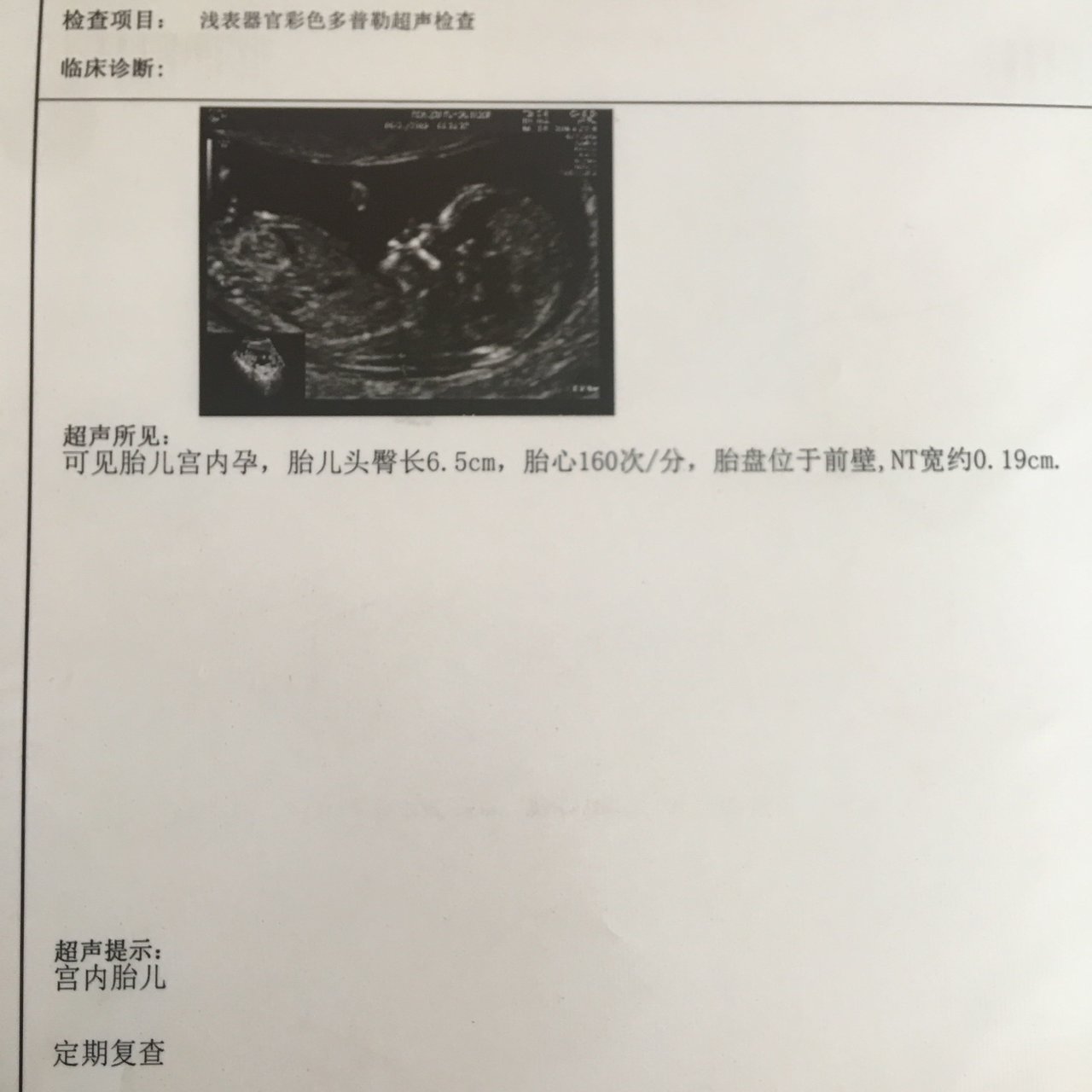nt通过
