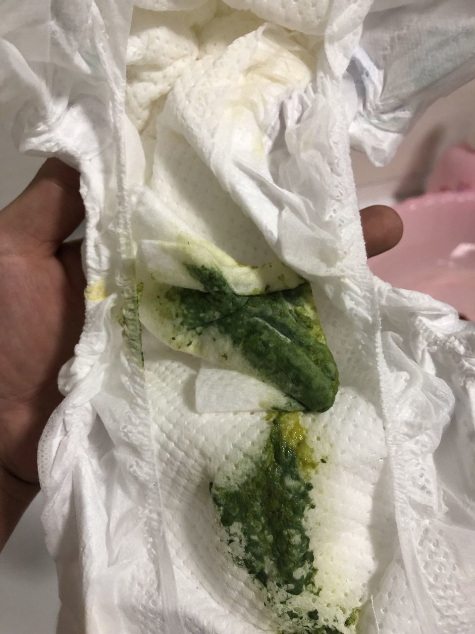 宝宝五个月 拉绿便 偶尔有沫