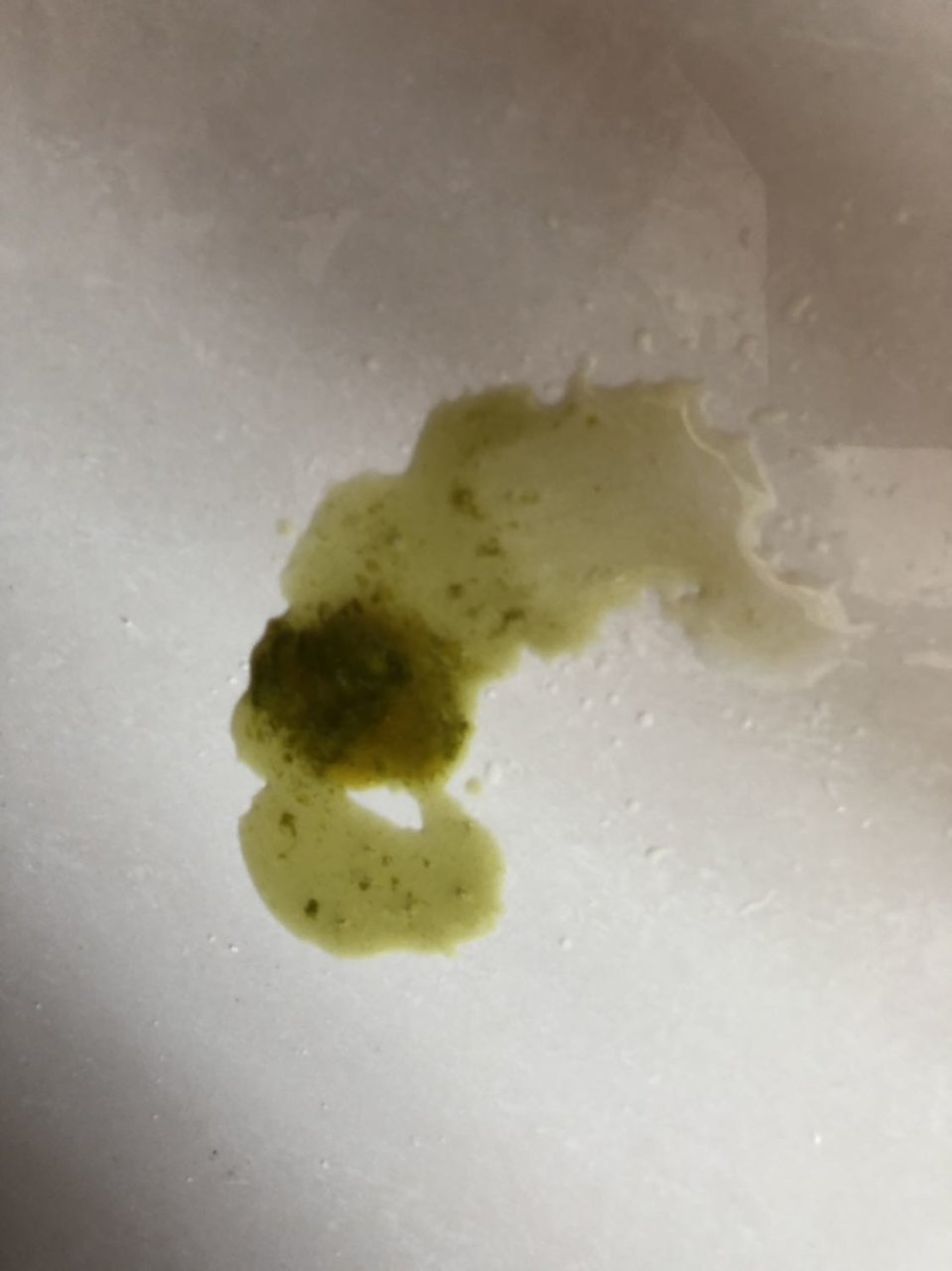宝宝五个月 拉绿便 偶尔有沫