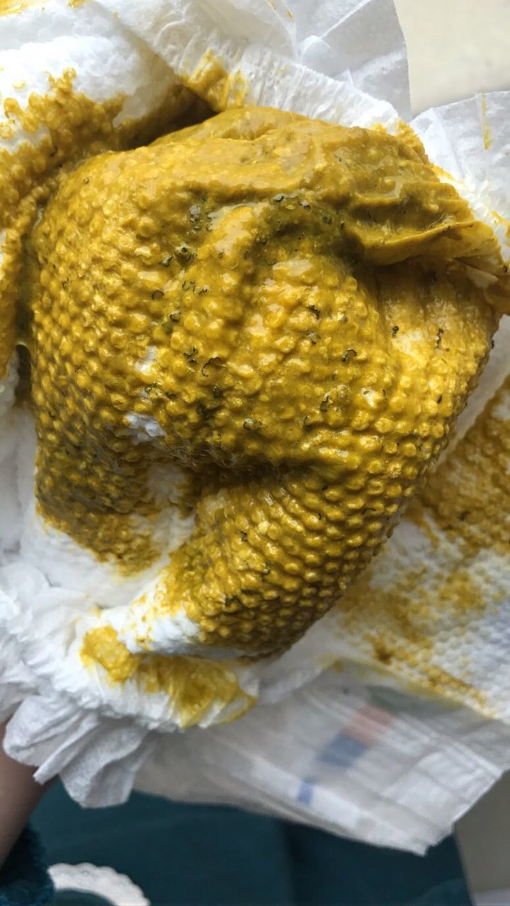 5个月宝宝吃香蕉后拉粑粑是这样的吗？