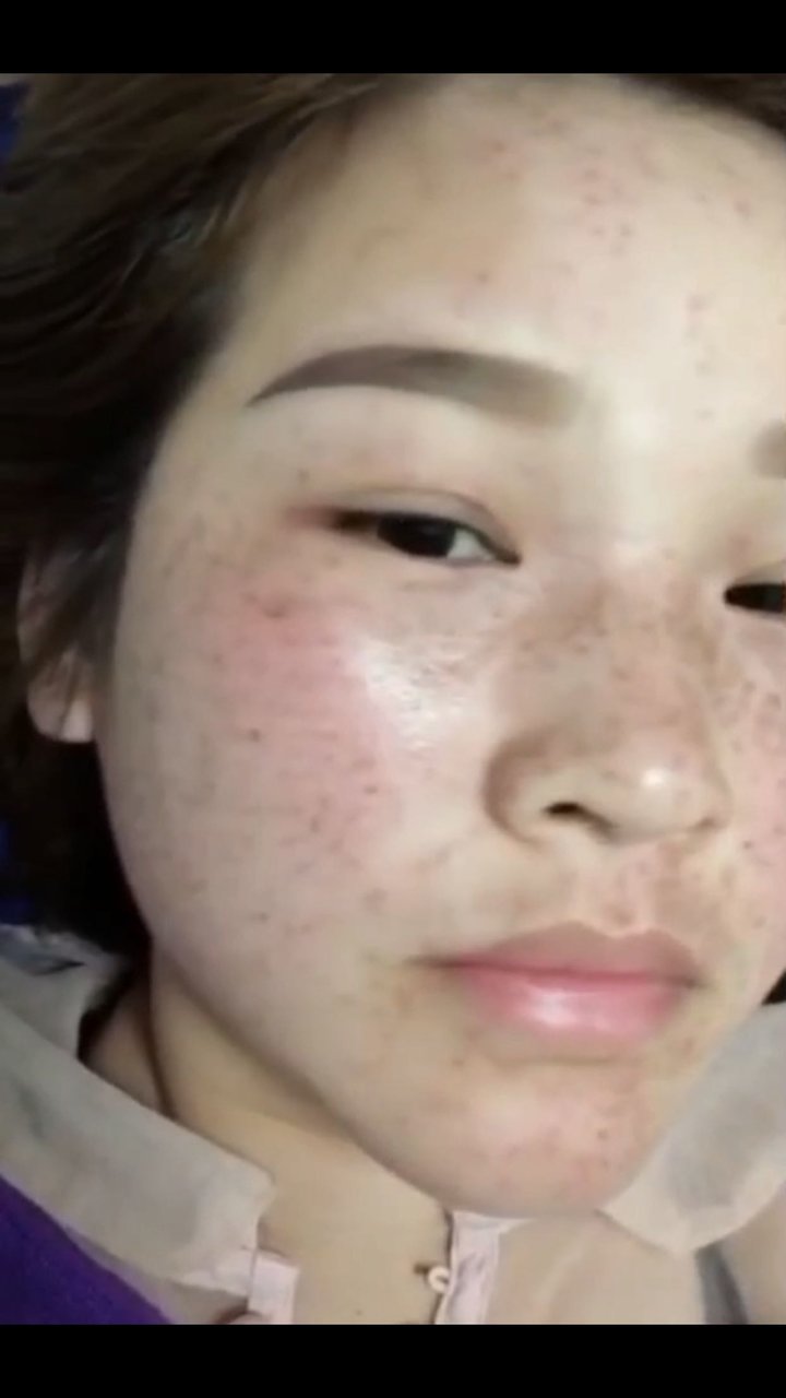 告别五年麻子脸，终于下班了