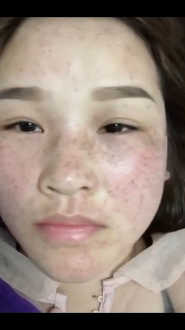 告别五年麻子脸，终于下班了