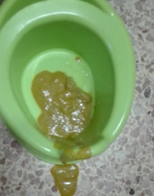 宝妈们，9个月的宝宝大便这样正常吗？