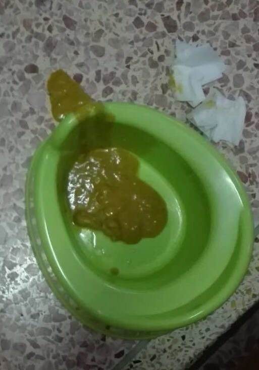 宝妈们，9个月的宝宝大便这样正常吗？