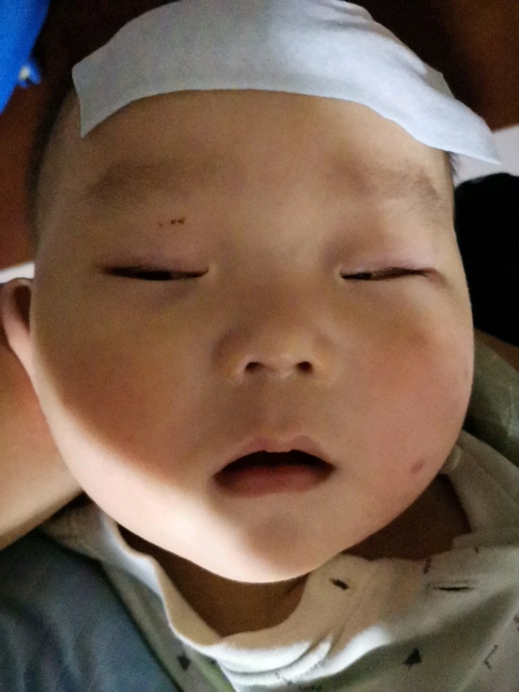 我宝生病，好心疼