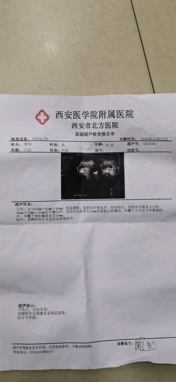 家人们现在好能看到是男孩女孩吗？68天