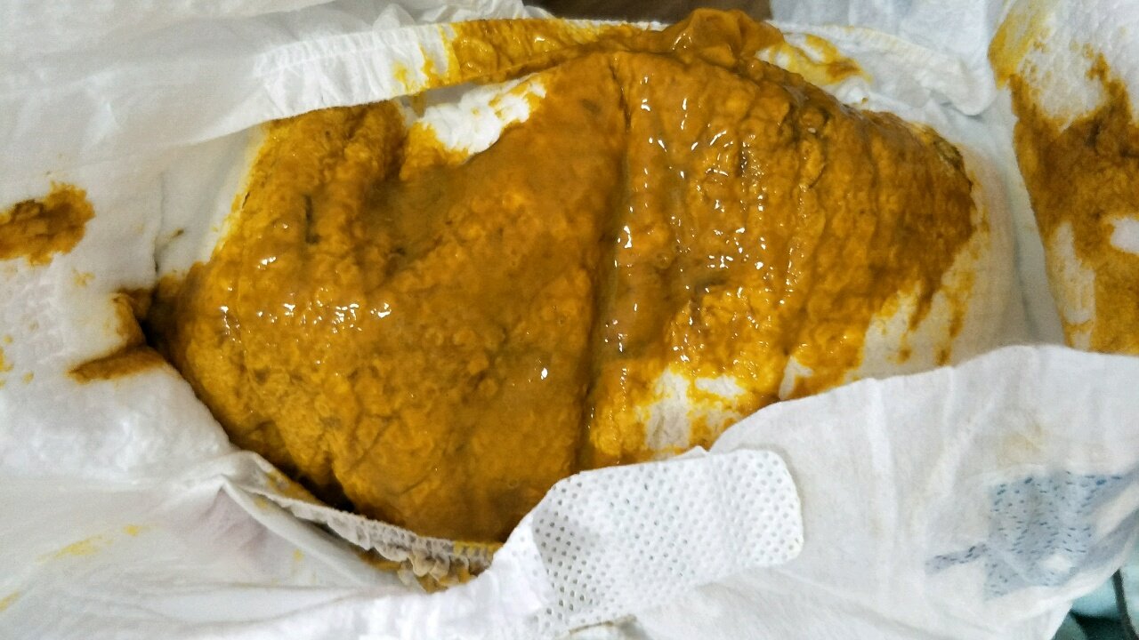 刚添加米粉大便这样是消化不良？