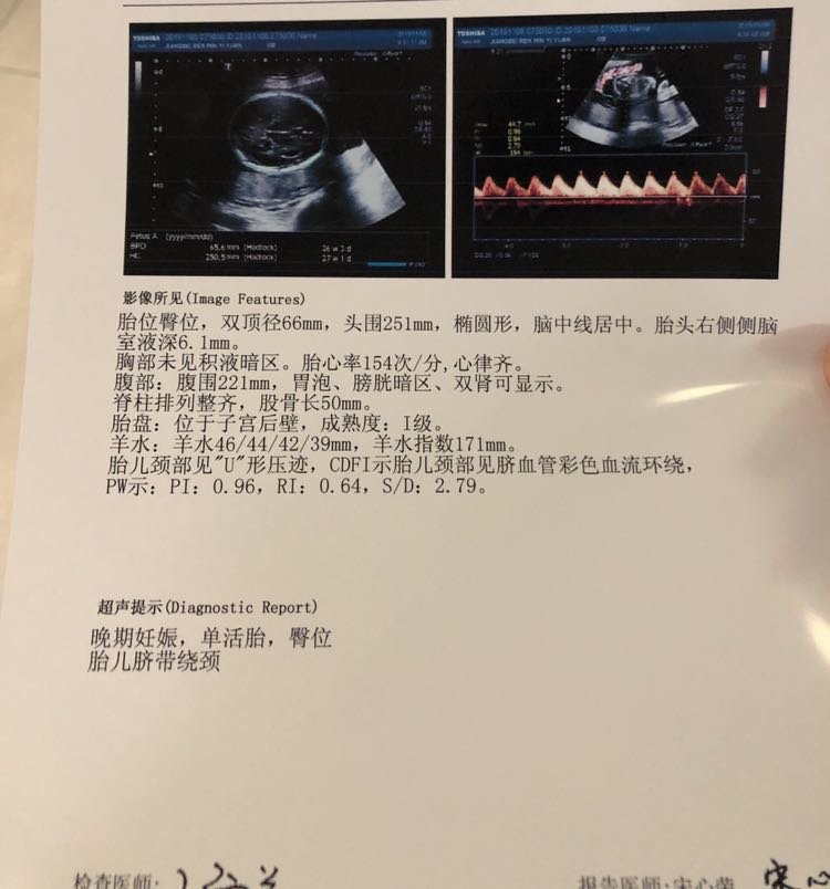 28周产检归来，心又领起来一下😭