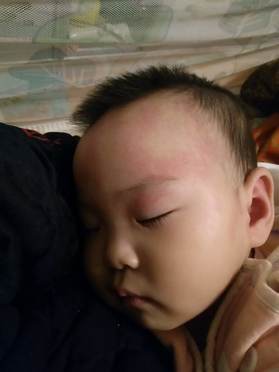 宝宝脸上长米米，很红