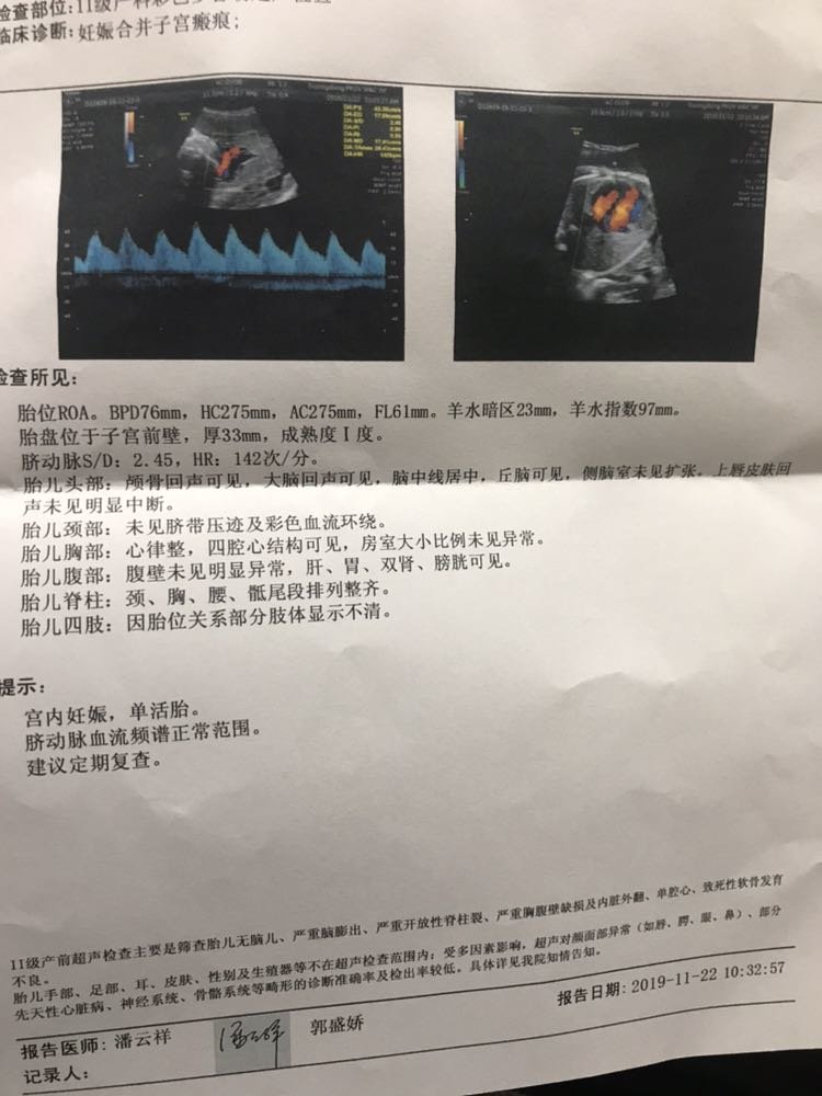 三胎都是吓大的