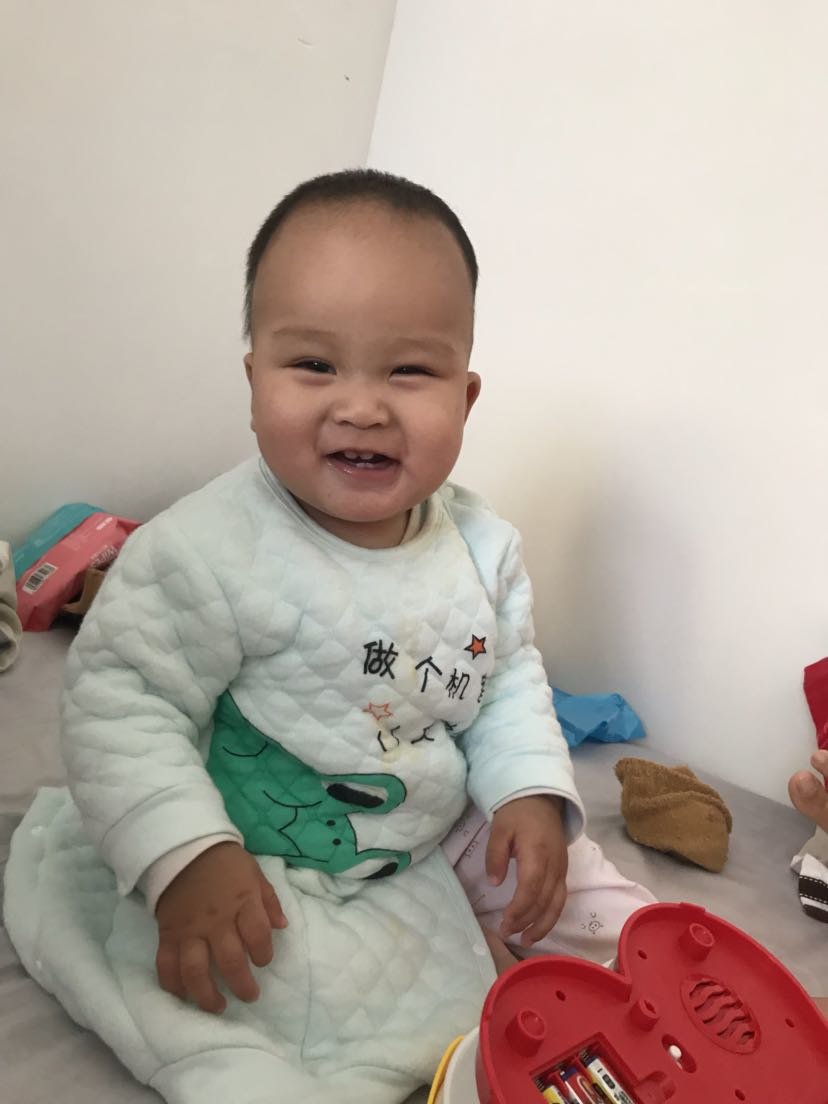 湿疹宝宝很头疼