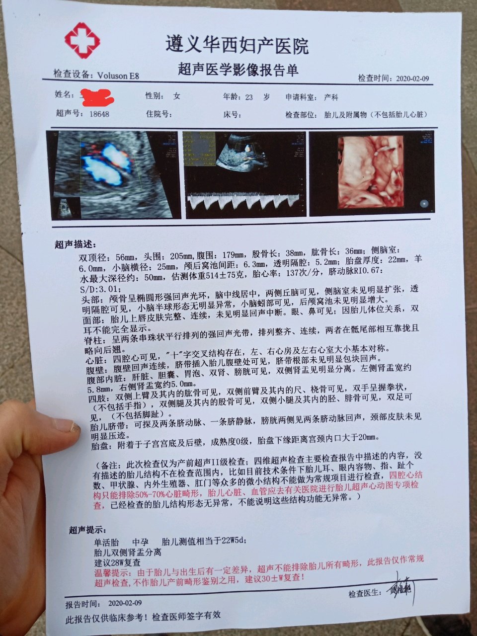 各位大神帮忙看看是男孩还是女孩，很是好奇😂😂