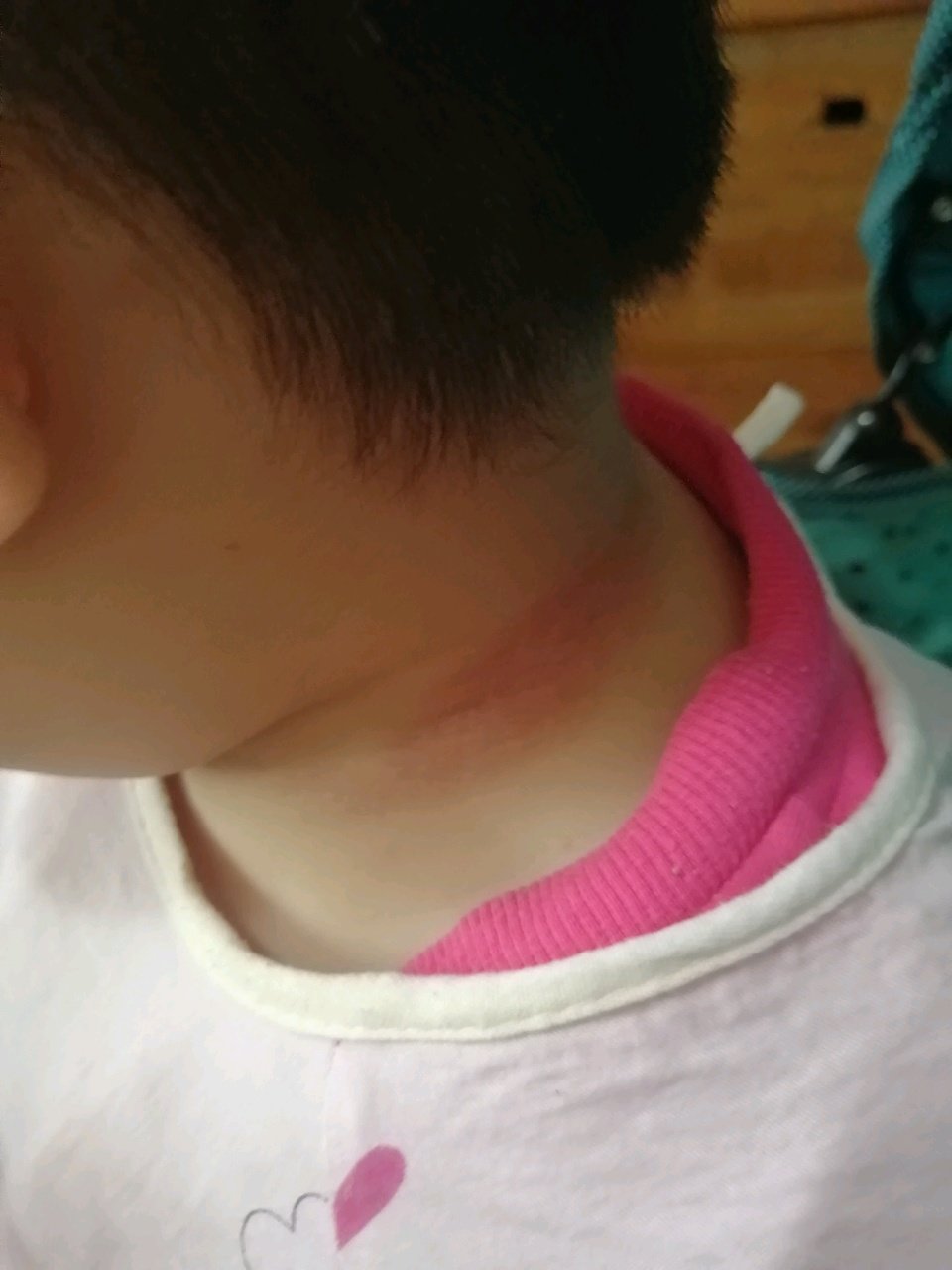 宝妈们，帮忙看一下这是什么