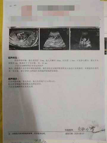 journal_insert_pic_1479132633