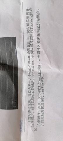 journal_insert_pic_1488605138