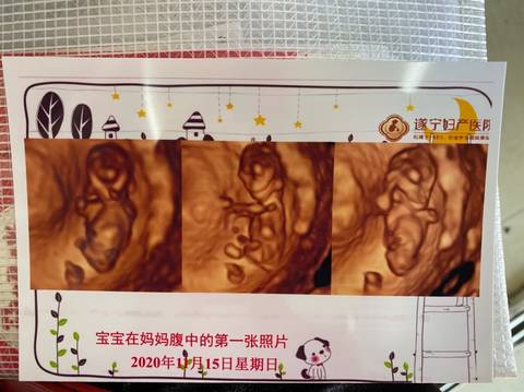 journal_insert_pic_1505563719