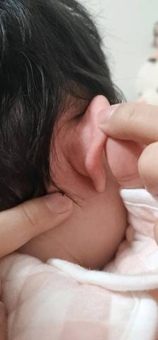 宝宝耳朵上长很多小疙瘩,一直挠,是长的什么啊?