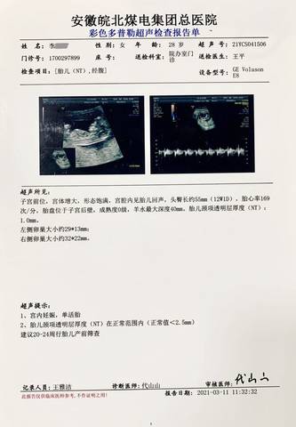 journal_insert_pic_1550470926