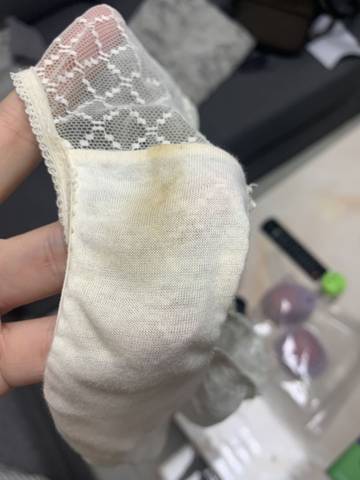 6周时发现怀孕了,去医院检查hcg正常,孕酮低,有黄褐色分泌物,医生给开