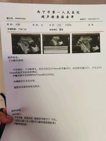 journal_insert_pic_1554758392
