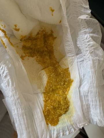 满月宝宝这样的大便正常吗