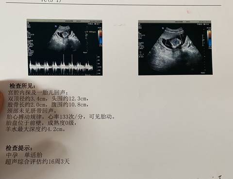 孕16周胎儿彩超图片