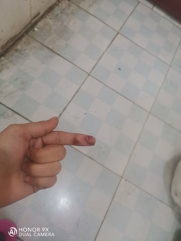 这着床出血还是来月经了 昨天开始出血量不多 一擦就有 宝宝树