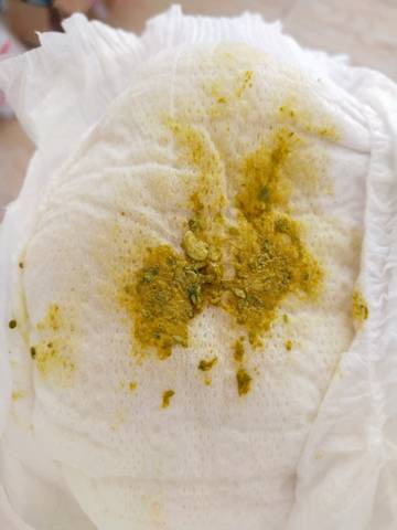 请问26天宝宝吃母乳这种大便正常吗